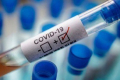 Украина в ТОП-5 стран Европы, максимально пораженных COVID-19