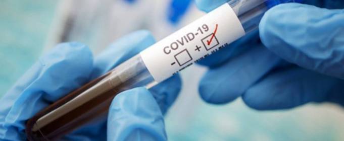 Спалах COVID-19 залишається неконтрольованим Спалах COVID-19 залишається неконтрольованим