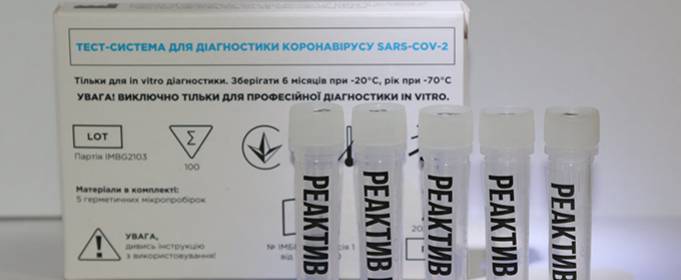 Украинские ученые разработали ПЛР-тест, определяющий коронавирус и два штамма вируса гриппа Украинские ученые разработали ПЛР-тест, определяющий коронавирус и два штамма вируса гриппа
