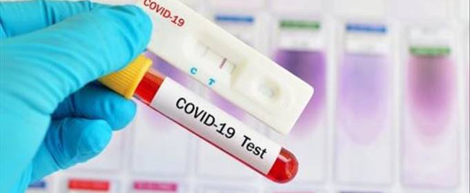 Добровольців у Великобританії повторно заразять COVID-19 Добровольців у Великобританії повторно заразять COVID-19